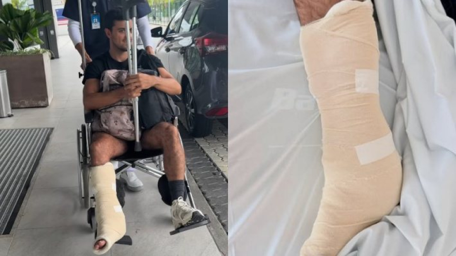 Ator da Globo sofre acidente e passa por cirurgia de emergência após grave lesão