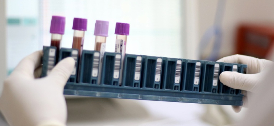 Bahia já tem pontos de coleta para exame genético de doenças raras no SUSBahia já tem pontos de coleta para exame genético de doenças raras no SUS