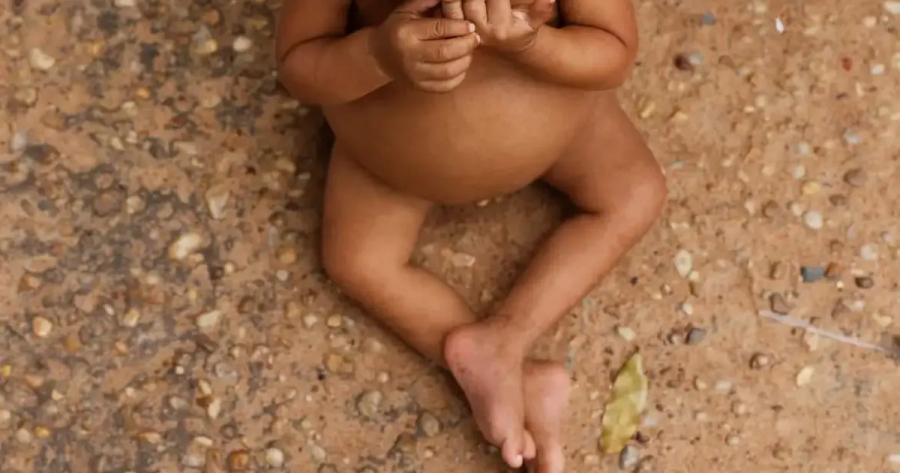 Casos de baixo peso aumentam na Bahia e superam média do país